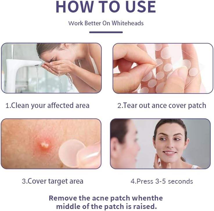 Medical Grade Acne Pimple Patch
