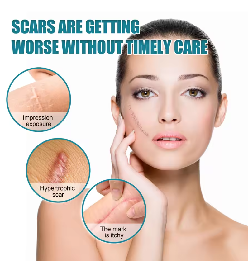 Silicone Scar Medical Skin Care & Pimples Removel Tape