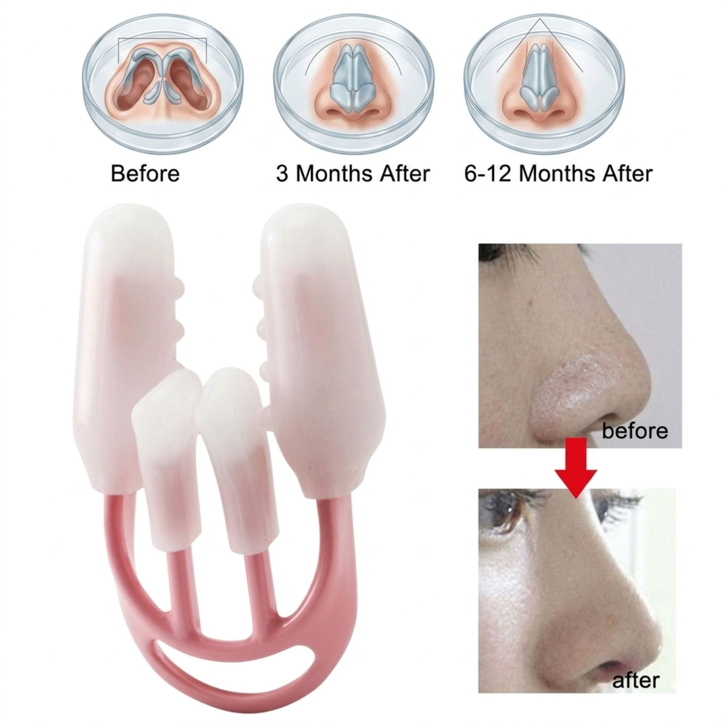 Nose Shaper Up Lifting Clip