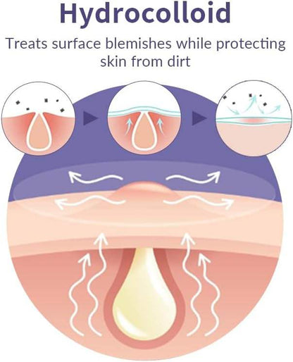 Medical Grade Acne Pimple Patch