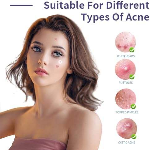 Medical Grade Acne Pimple Patch