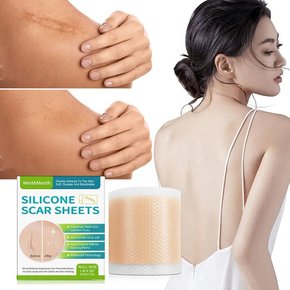 Silicone Scar Medical Skin Care & Pimples Removel Tape