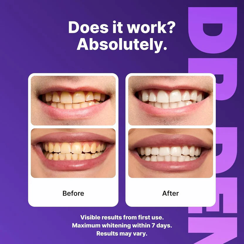Purple Instant Teeth Whitening Strips