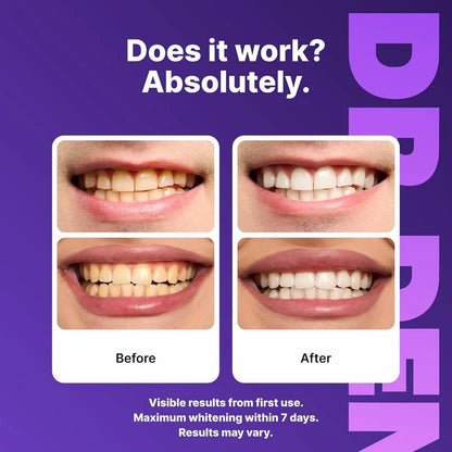 Purple Instant Teeth Whitening Strips