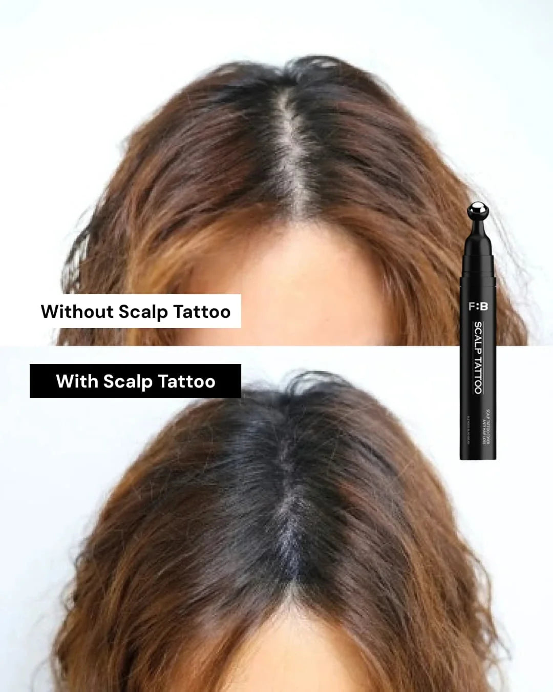 Scalp Micropigmentation Tattoo For Hair