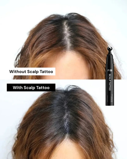 Scalp Micropigmentation Tattoo For Hair